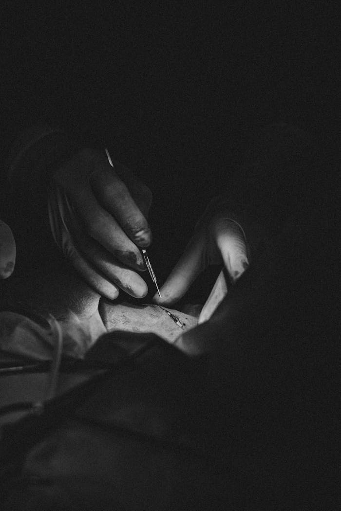 gallery-5 Close-up of a precise surgical operation in a sterile environment, highlighting surgeon's expertise.